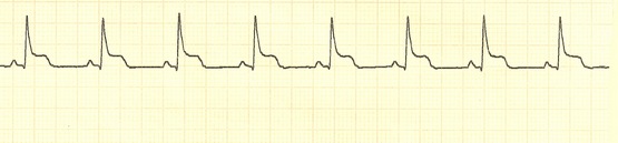 SR82withSTelevation.jpg